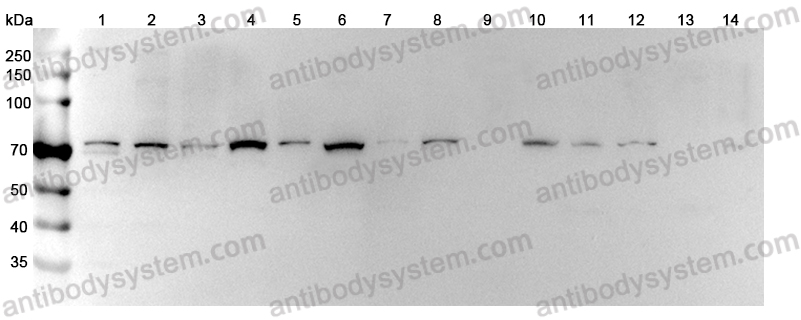 Anti-PIK3R1/PI3-kinase p85-alpha Polyclonal Antibody